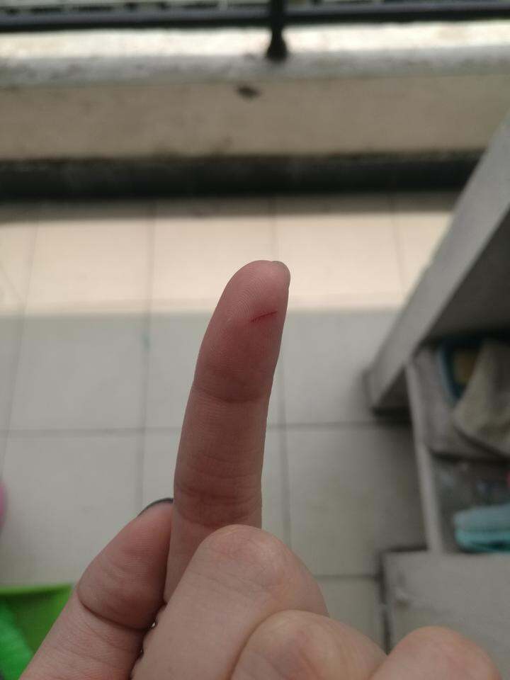 划破手指的就是这个地方,铁丝太突出,开伞收伞不注意就会割到