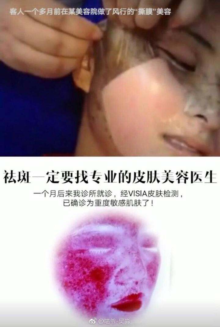 这是把脸皮撕下来了吧