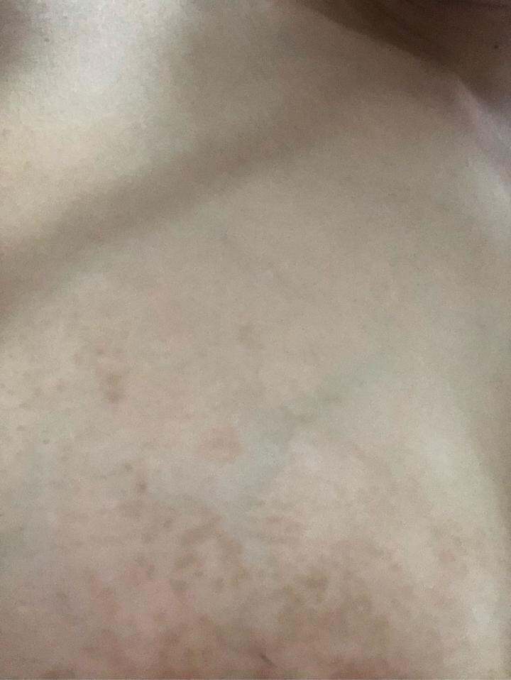 万能的路口er,有不有人可以告诉我胸上这个长的是什么