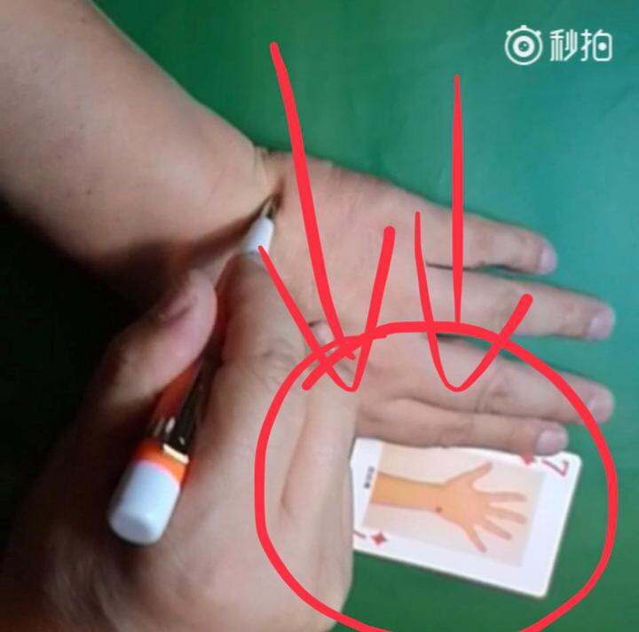 久病成医之胆囊炎按摩缓解
