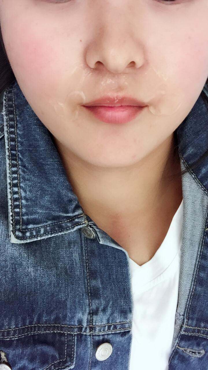 唇部脱毛
