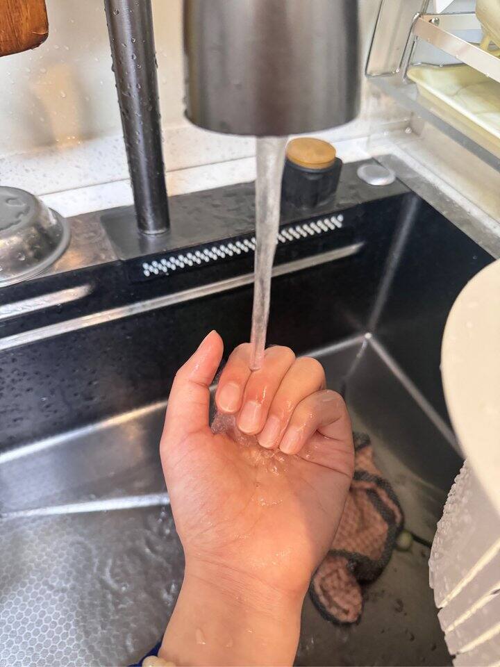 高温蒸汽烫伤了休息几天