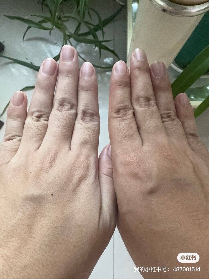 邪修手部美白是真的？！苹果15PM原图直出