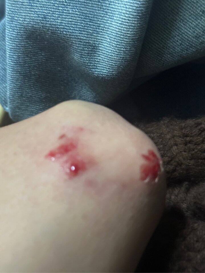 可能这是我激动的原因🌚