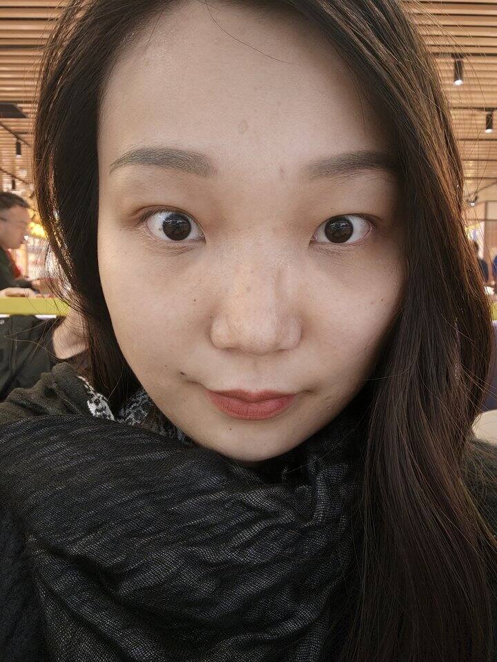 哈哈，我真的好满意我的眼袋泪沟手术