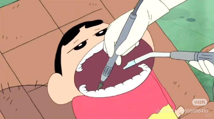 正畸进度2⃣️/36