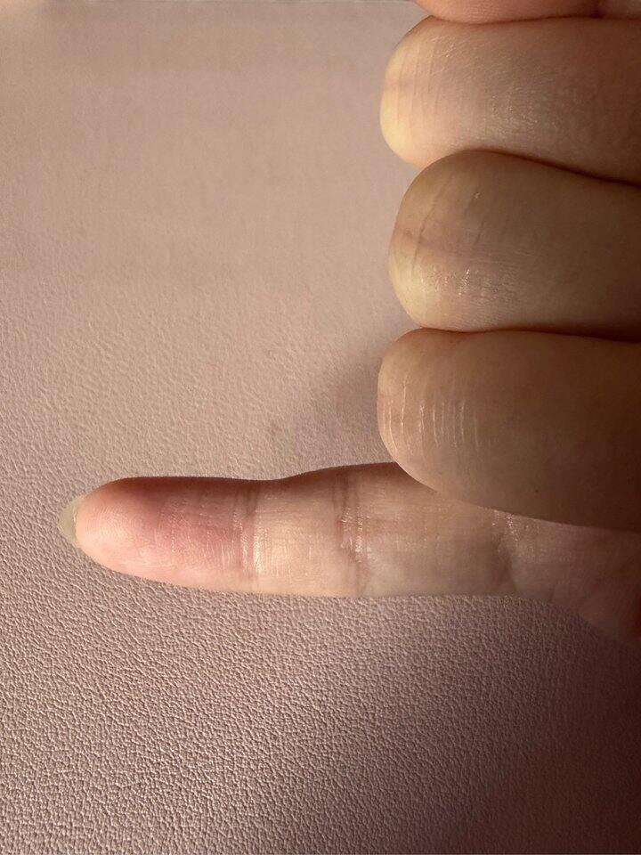 以后尽量不举着手机了