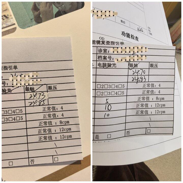 戴镜25天（控优点）