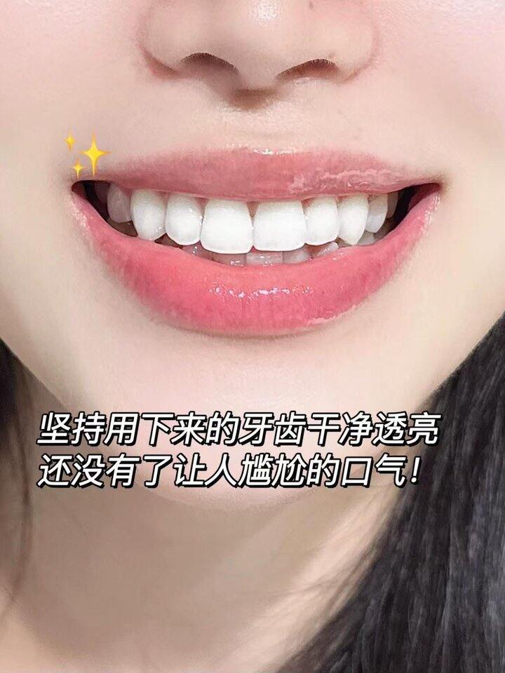 冷酸灵牙膏！💰4+