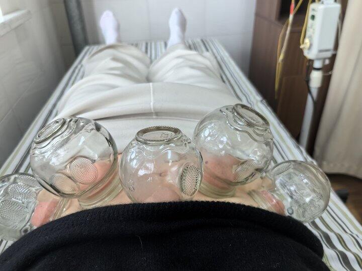 胃胀气胃疼针灸很有效