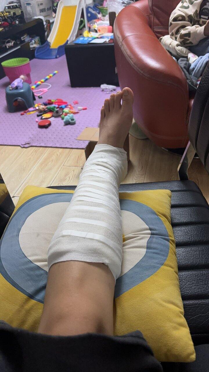 大冤种骨折，今天第一天