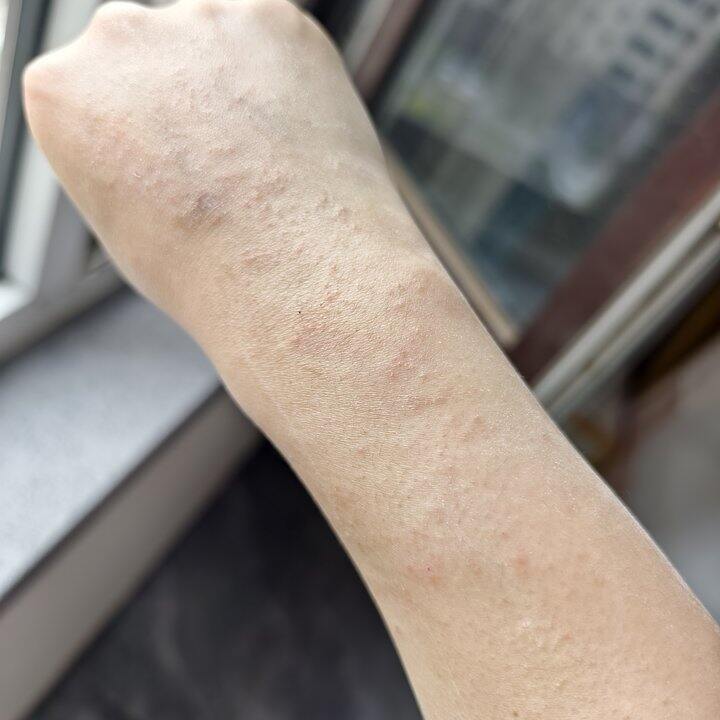 唉