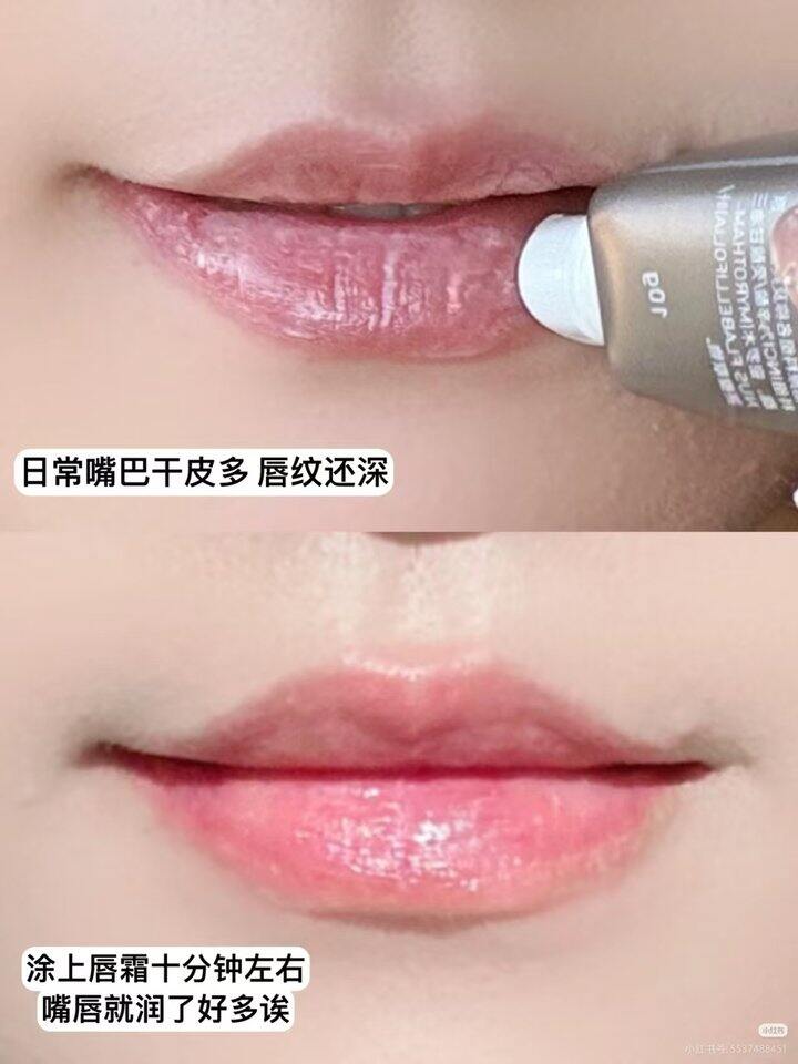 🍎36.9💰唇纹熨烫机“毕生之研”