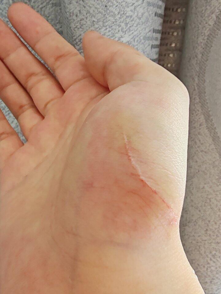 又又又让猫抓伤了