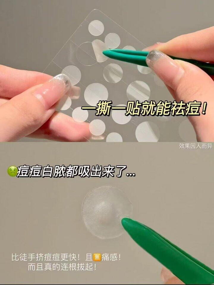 痘痘贴