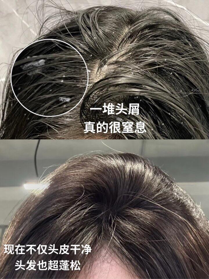 科丽尼！你是懂雪花油头的！💰14