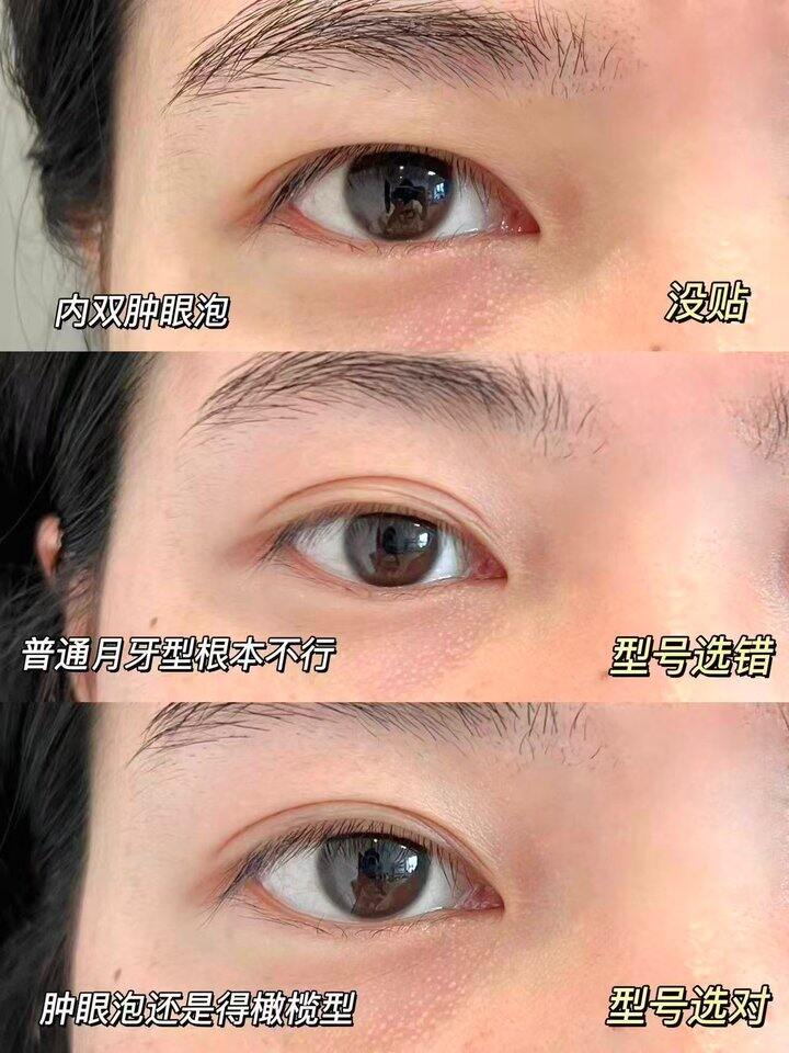 尔木萄双眼皮贴！
