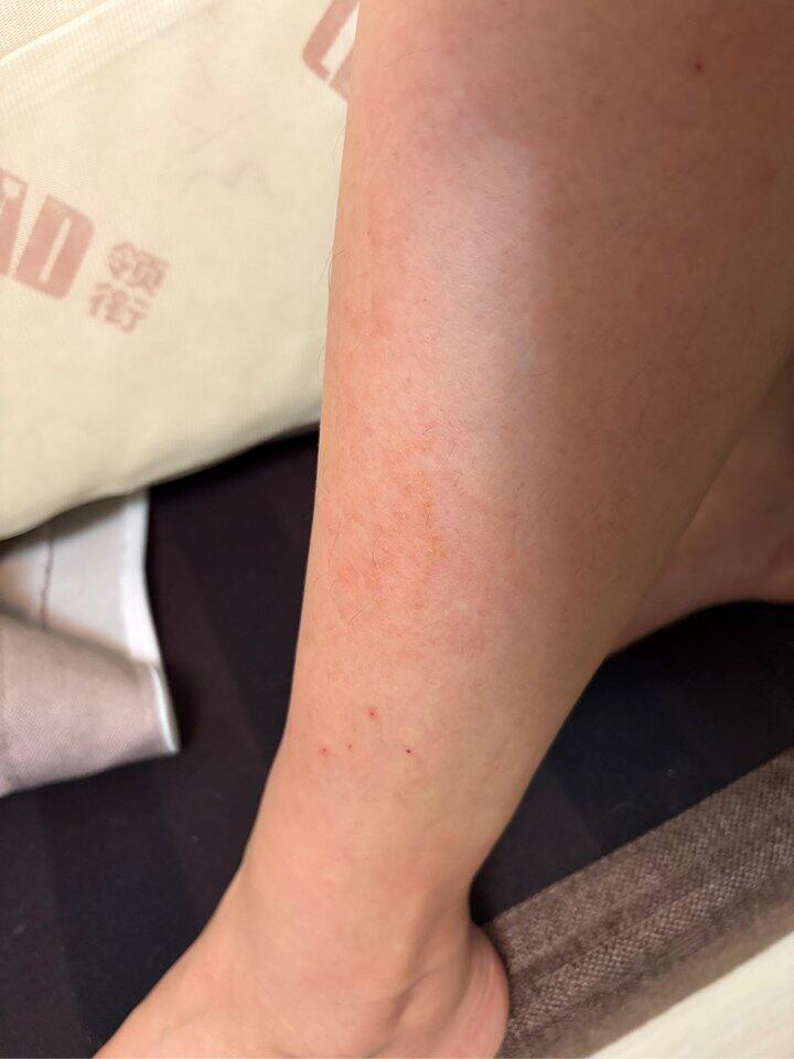 免疫力不行了